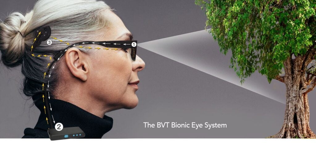 The bionic eye system from BVT